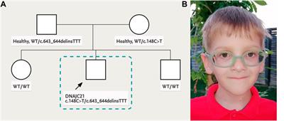 Case Report: Novel Biallelic Variants in DNAJC21 Causing an Inherited Bone Marrow Failure Spectrum Phenotype: An Odyssey to Diagnosis